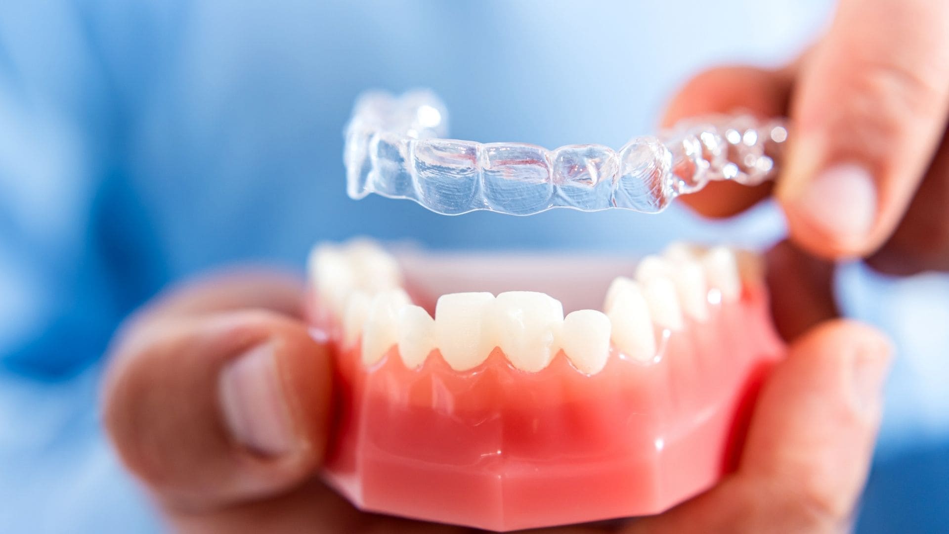 Aligners there cost, benefits & working in Guwahati