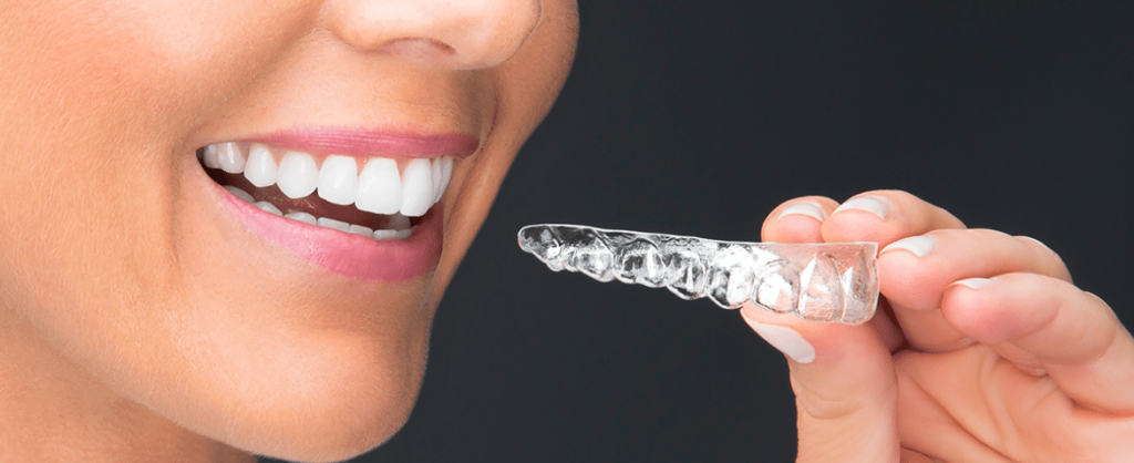 cost aligners at Family Dental Clinic guwahati
