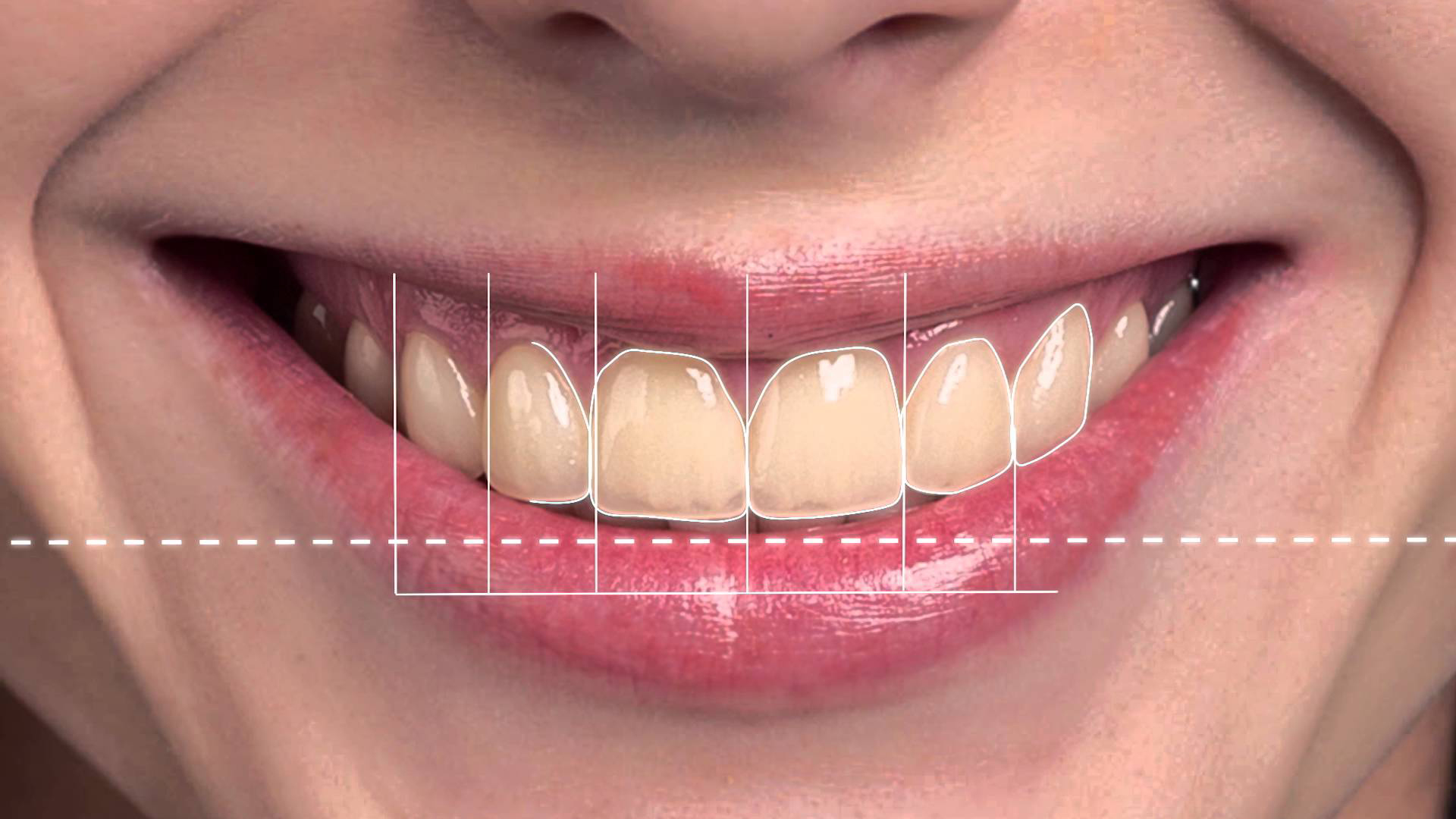 Transform Your Smile and Boost Your Confidence with Smile Designing in Guwahati